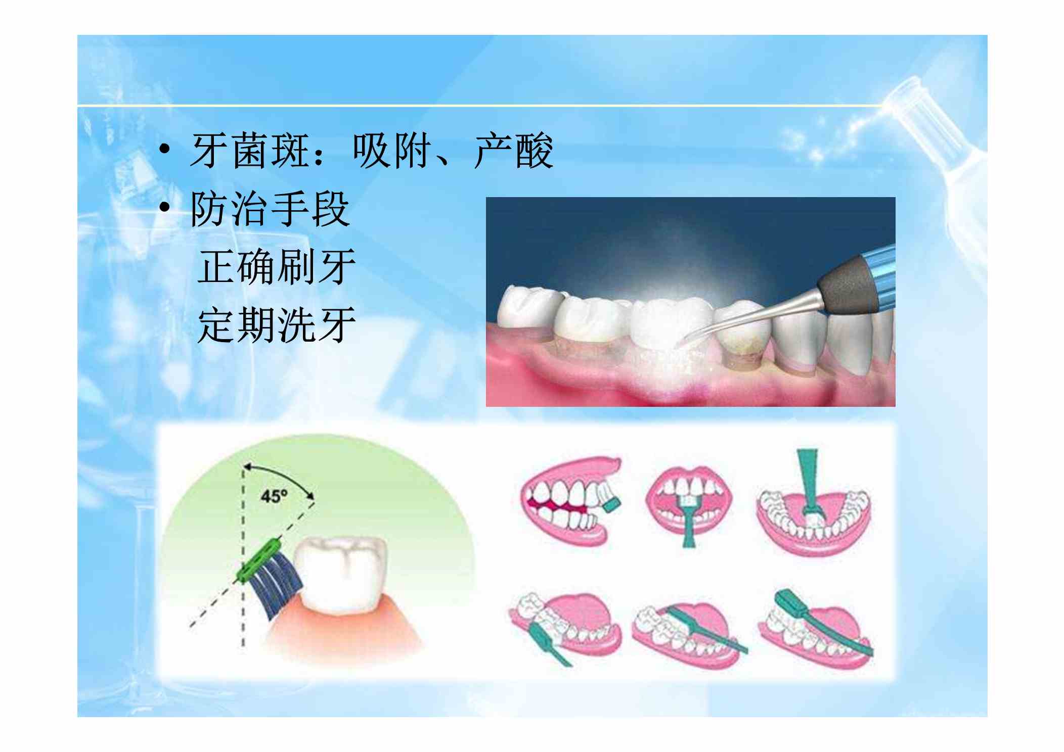 從齲病病因四聯因素理論