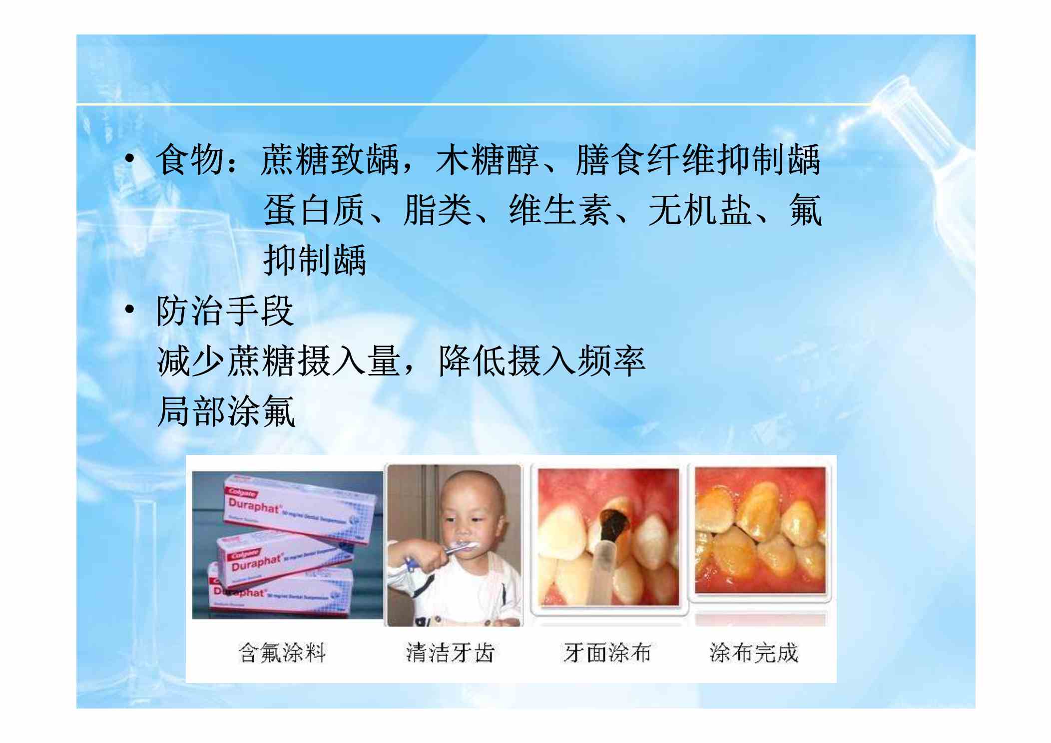 从龋病病因四联因素理论